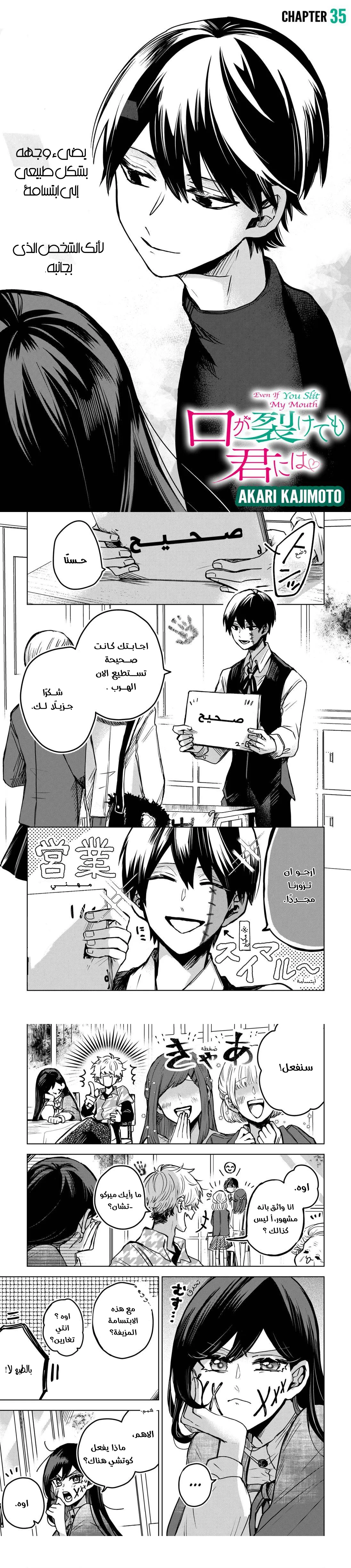 Read Kuchi ga Saketemo Kimi Niwa AR Manga Online